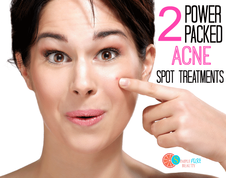 2 Power Packed Acne Spot Treatments Using Just 2 Ingredients Simple