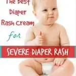 The Best Diaper Rash Cream for Severe Diaper Rash | SimplePureBeauty.com #diaperrash #rash #diapercream