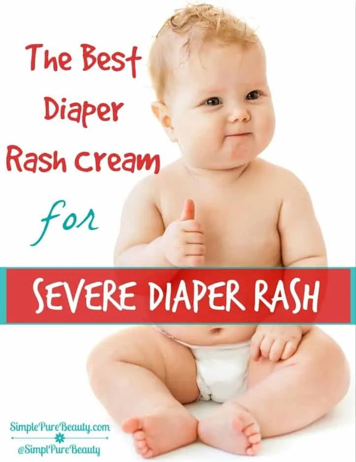 The Best Diaper Rash Cream for Severe Diaper Rash | SimplePureBeauty.com #diaperrash #rash #diapercream