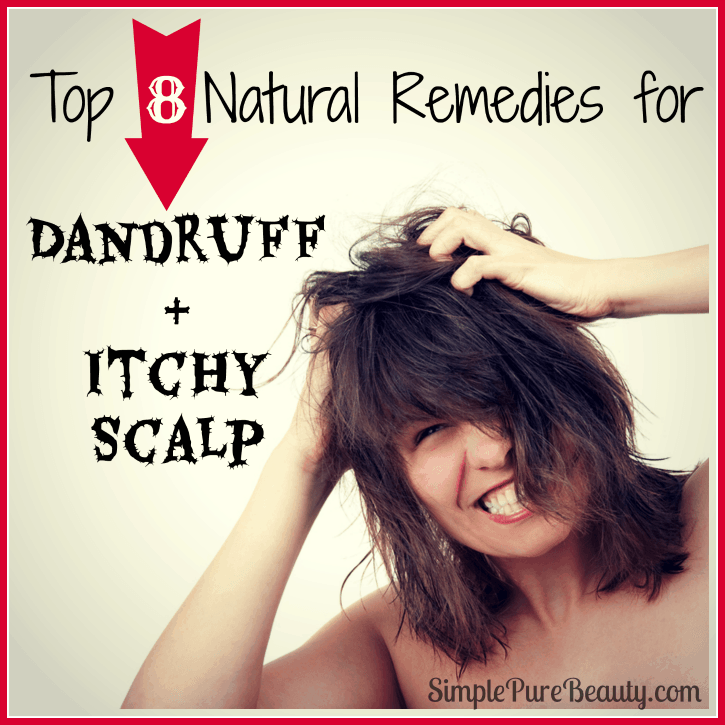 Top 8 Natural Home Remedies For Dandruff And Itchy Scalp Simple Pure