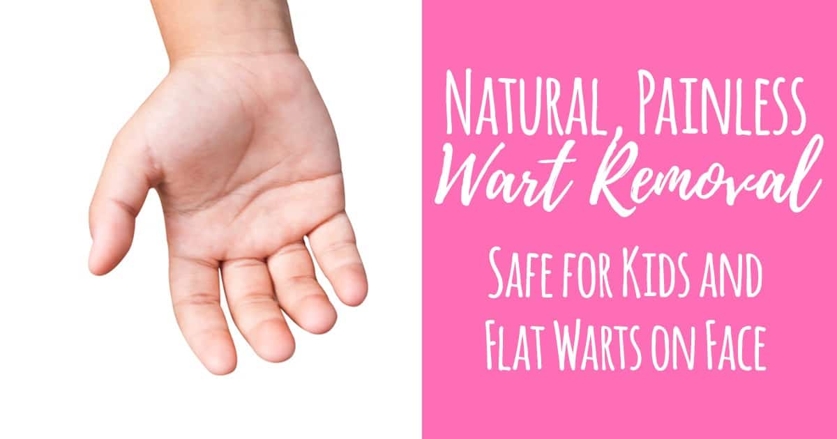 Natural-Wart-Removal-FB.jpg