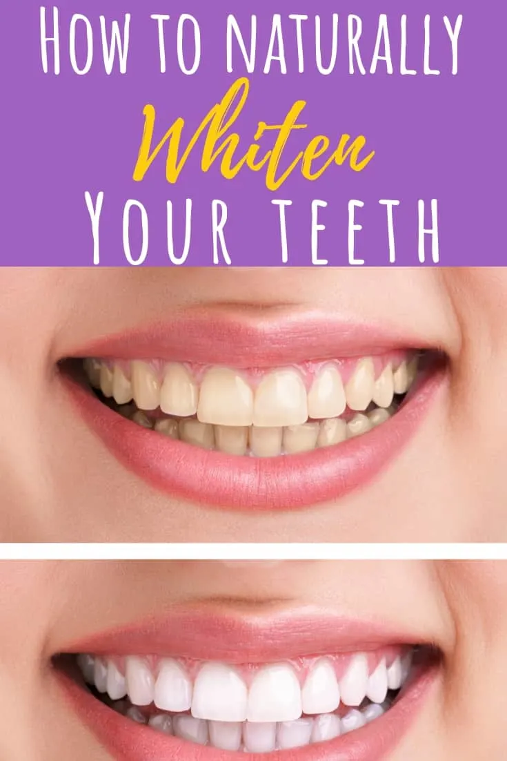 Whitening your teeth naturally is simple to do! With these simple DIY tips, you can have the brightest smile in the room in no time at all! #naturallywhitenyourteeth #brightsmile #whitenyourteeth #DIY #homemadeteethwhitener